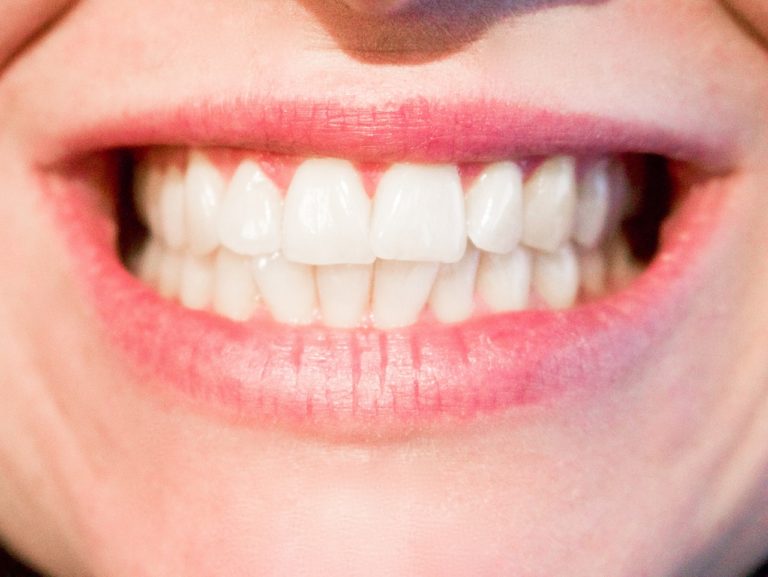 Obecna technologia wykorzystywana w salonach stomatologii estetycznej zdoła sprawić, że odzyskamy ładny uśmiech.